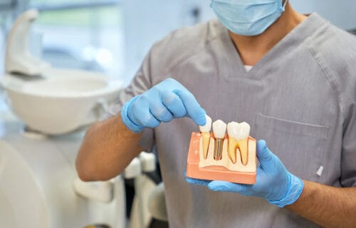 Dental implants procedure illustrated with high precision tools and a 3D dental implant model showcasing the stages of implantation in a dentist's office in Oakland, NJ –– highlighting advanced dentistry techniques for tooth replacement.