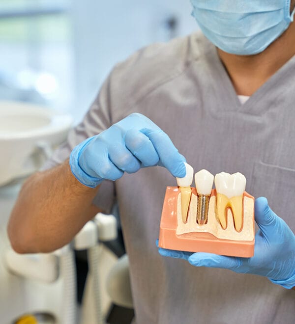 Dental implants procedure illustrated with high precision tools and a 3D dental implant model showcasing the stages of implantation in a dentist's office in Oakland, NJ –– highlighting advanced dentistry techniques for tooth replacement.