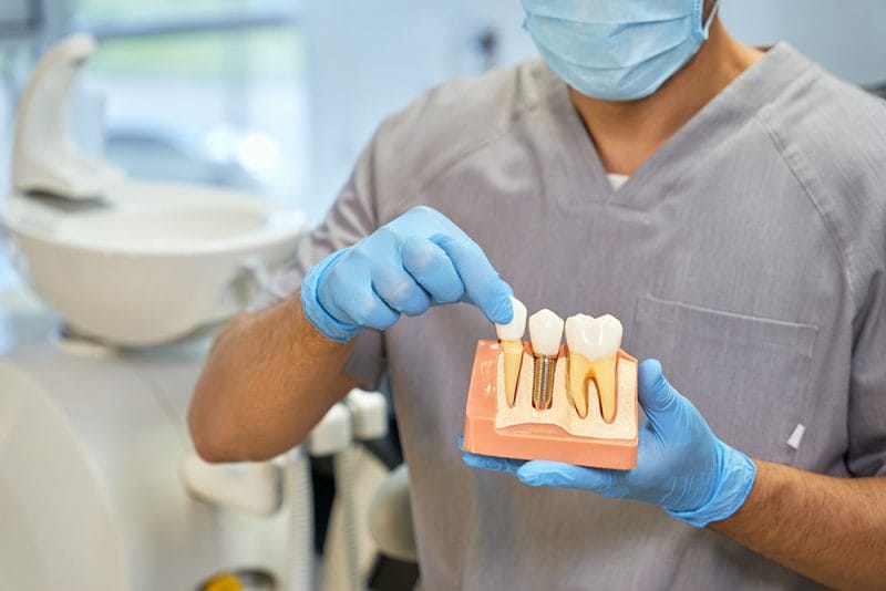 Dental implants procedure illustrated with high precision tools and a 3D dental implant model showcasing the stages of implantation in a dentist's office in Oakland, NJ –– highlighting advanced dentistry techniques for tooth replacement.
